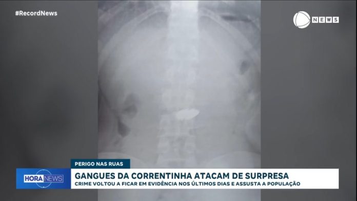 Adolescente é apreendido ao engolir corrente de ouro de R$ 10 mil; saiba como se proteger do crime - Notícias