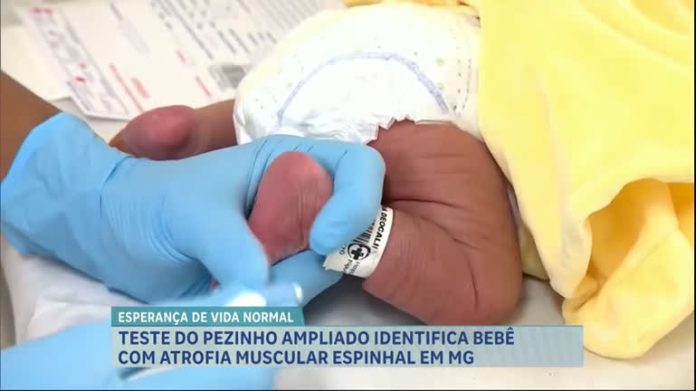 Teste do pezinho identifica primeiro caso de atrofia muscular espinhal em recém-nascida de MG