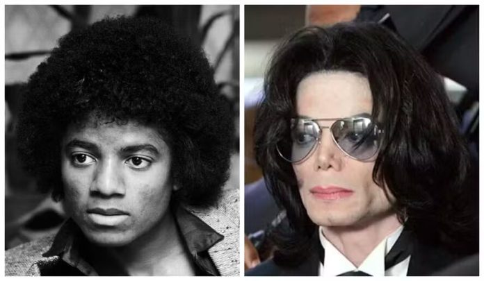 CHOCANTE! Entenda por que Michael Jackson fez tantas plásticas no nariz