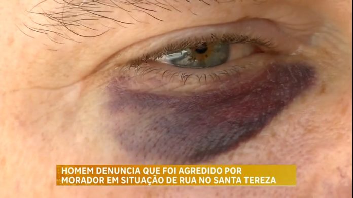 Homem denuncia que foi agredido por morador em situação de rua em BH