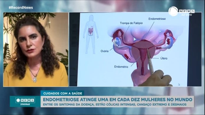 ‘Nem sempre a cólica é valorizada, acham que é normal sentir dor’, diz especialista, sobre a endometriose - Notícias